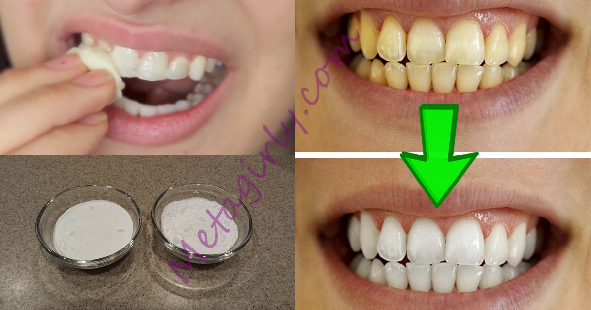 Image result for Guaranteed Teeth Whitening In Less Than 2 Minutes!
